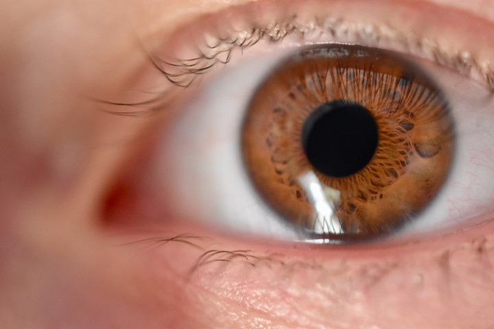 Vision100 Augenärzte Behandlung der Makuladegeneration OCT